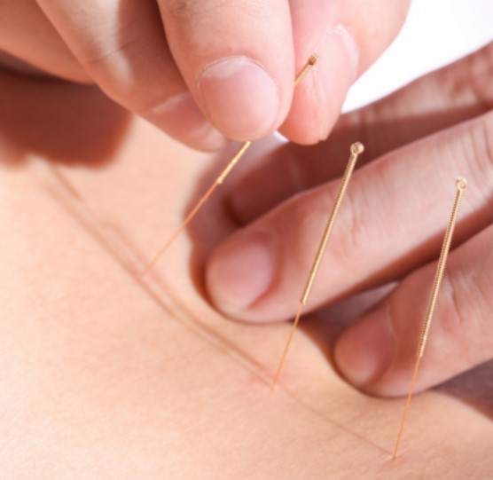 Full Gold Plated Acupuncture Needles (One Needle With One Tube)