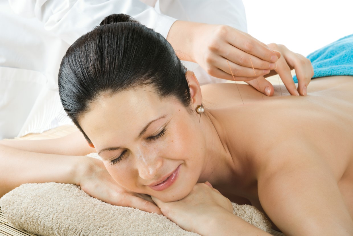 铜柄环柄针女士背部