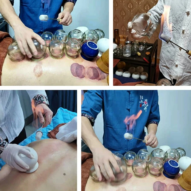 Glass Cupping Fire Rod 